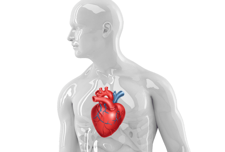 rendering of a person with AFib and their heart, indicating an increased risk for stroke